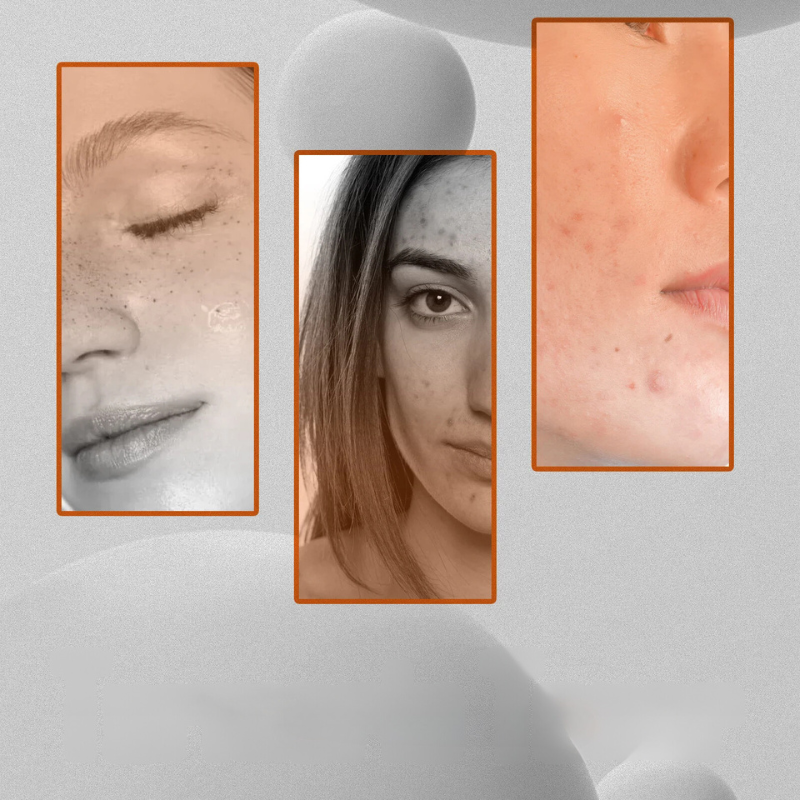 Spotless Glow Toner – Korrektur dunkler Flecken und aufhellende Gesichtspflege