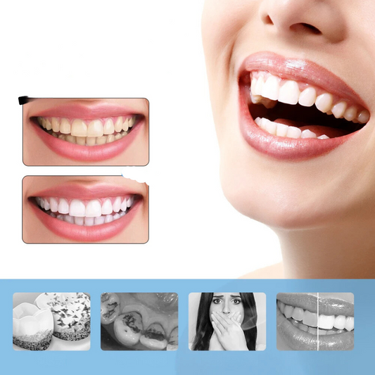 FreshWhite - 6-biegowa elektryczna wybielacz do zębów i skaler