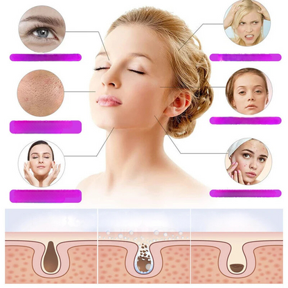 LumiThera - High-Frequency Skin & Eye Care Wand with Ozone Technology