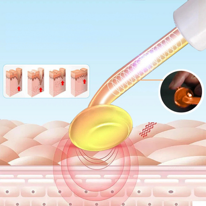 GlowWave - High-Frequency Electrode Wand for Skin Tightening & Wrinkle Removal