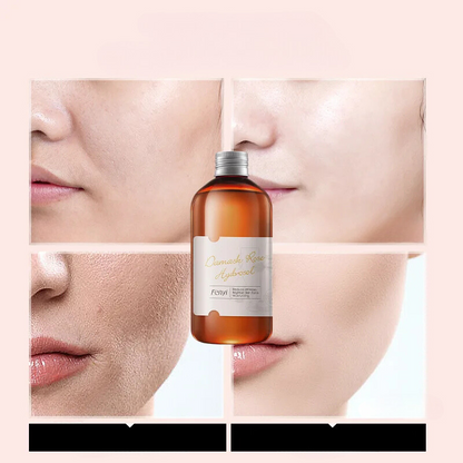 RoseHydra Mist - Nourishing Rose Water Toner for Dry Skin Care