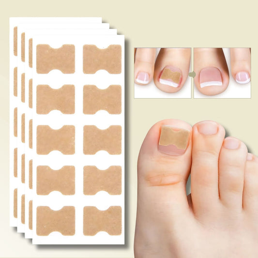 Fungi Nail Patches for Instant Relief from Ingrown Nails and Nail Fungus – 10 Count 0