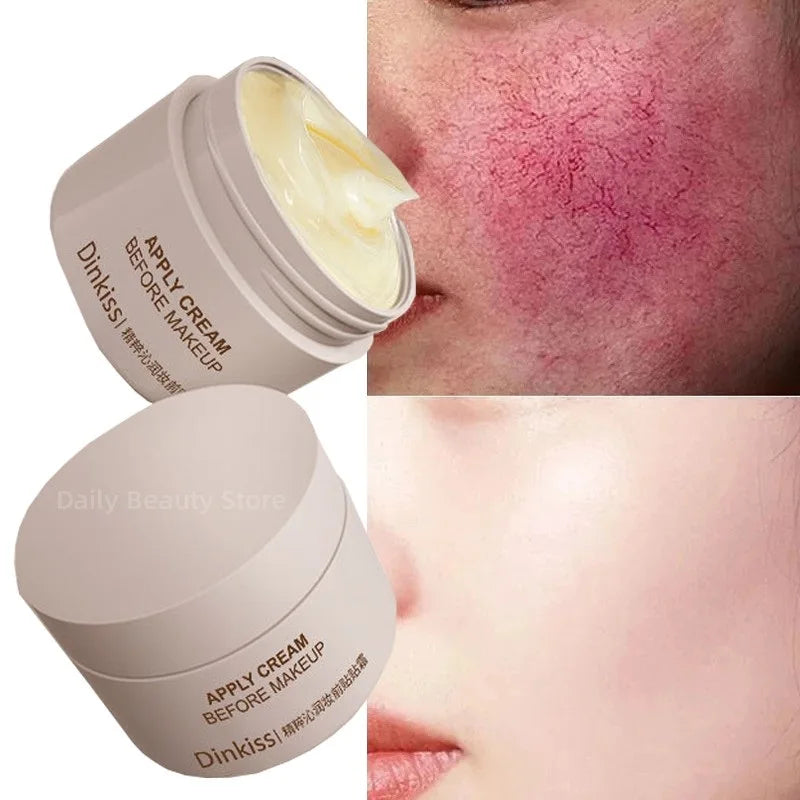 CalmAura Repair Cream – For Rosacea & Skin Redness Relief