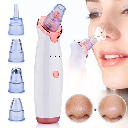 GlowClean - Blackhead & Acne Vacuum Tool