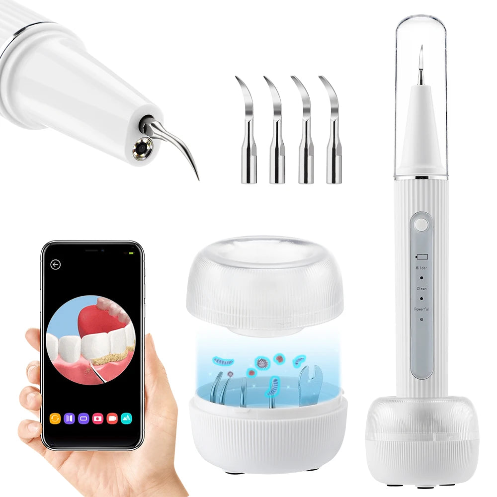 SparkleScan - Ultrasonic Dental Cleaner & Calculus Eliminator