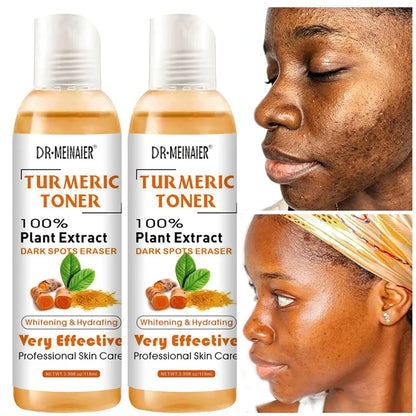 K-Glow Essentials - Turmeric Moisturizing Toner with Vitamin C & Ginger Essence