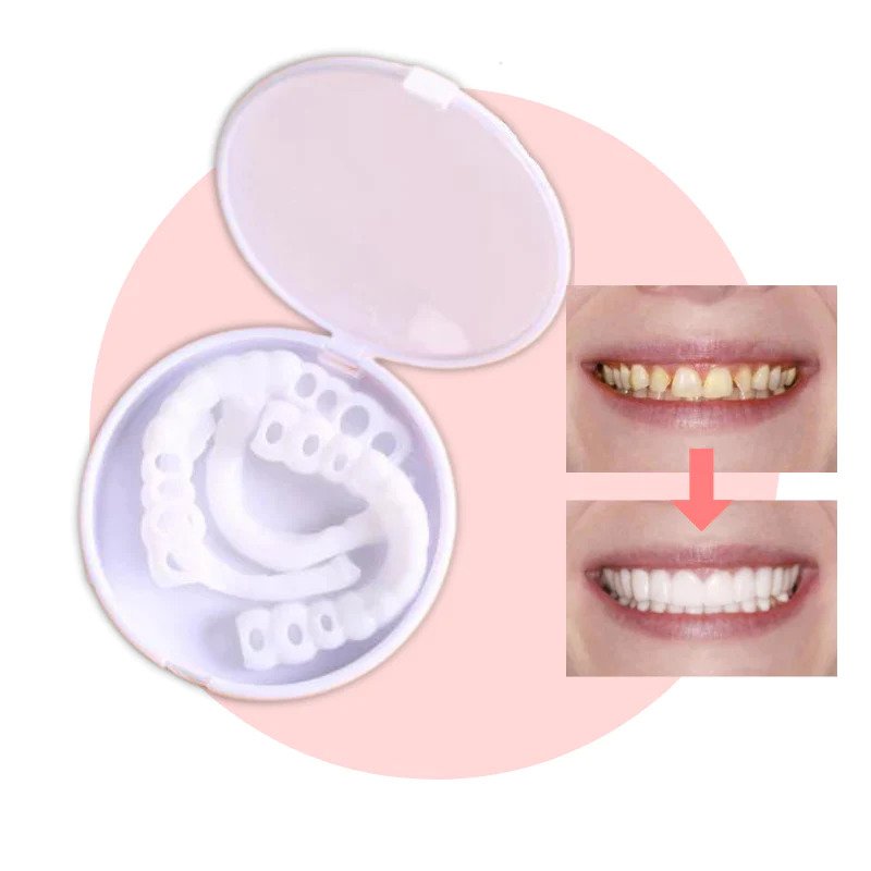 Vivolux | SmileSnap - Always the perfect smile with these veneers 0