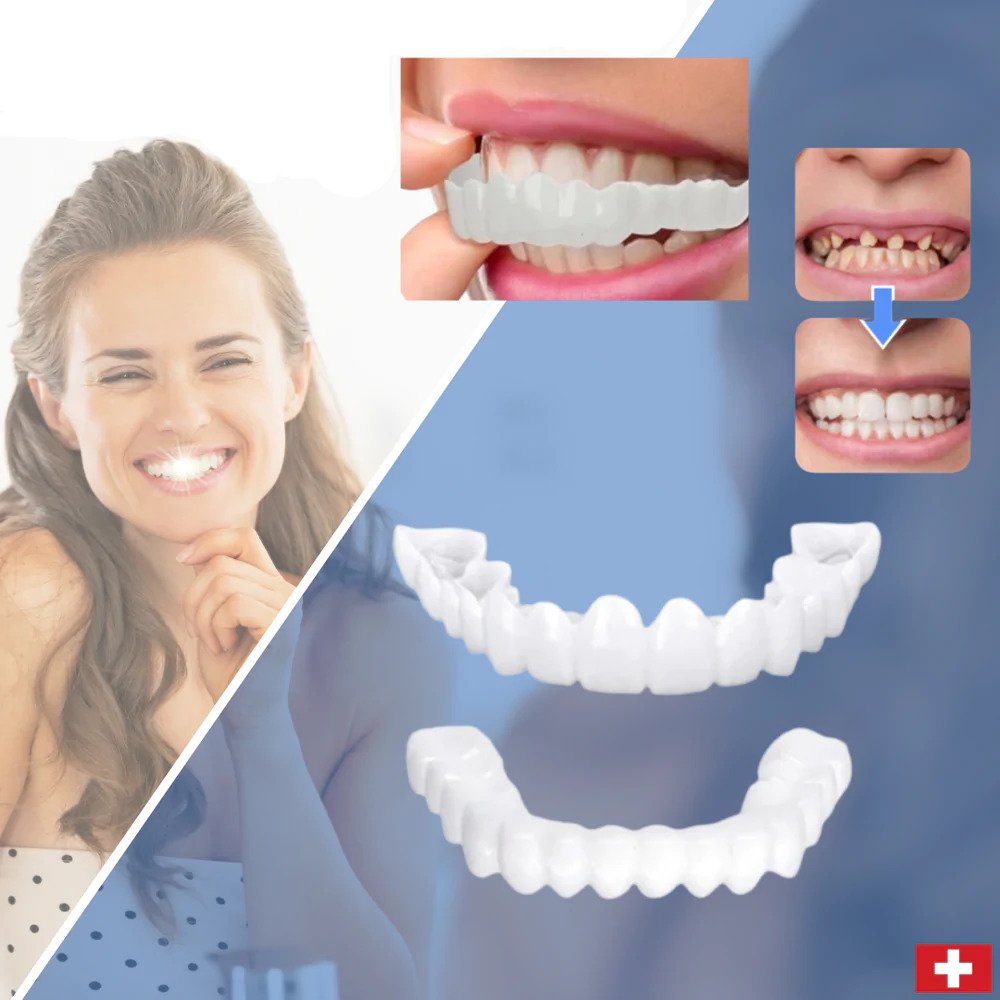 Vivolux | SmileSnap - Always the perfect smile with these veneers 2